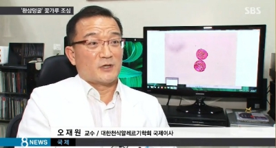 눈물·콧물 줄줄…알레르기 부르는 환삼덩굴